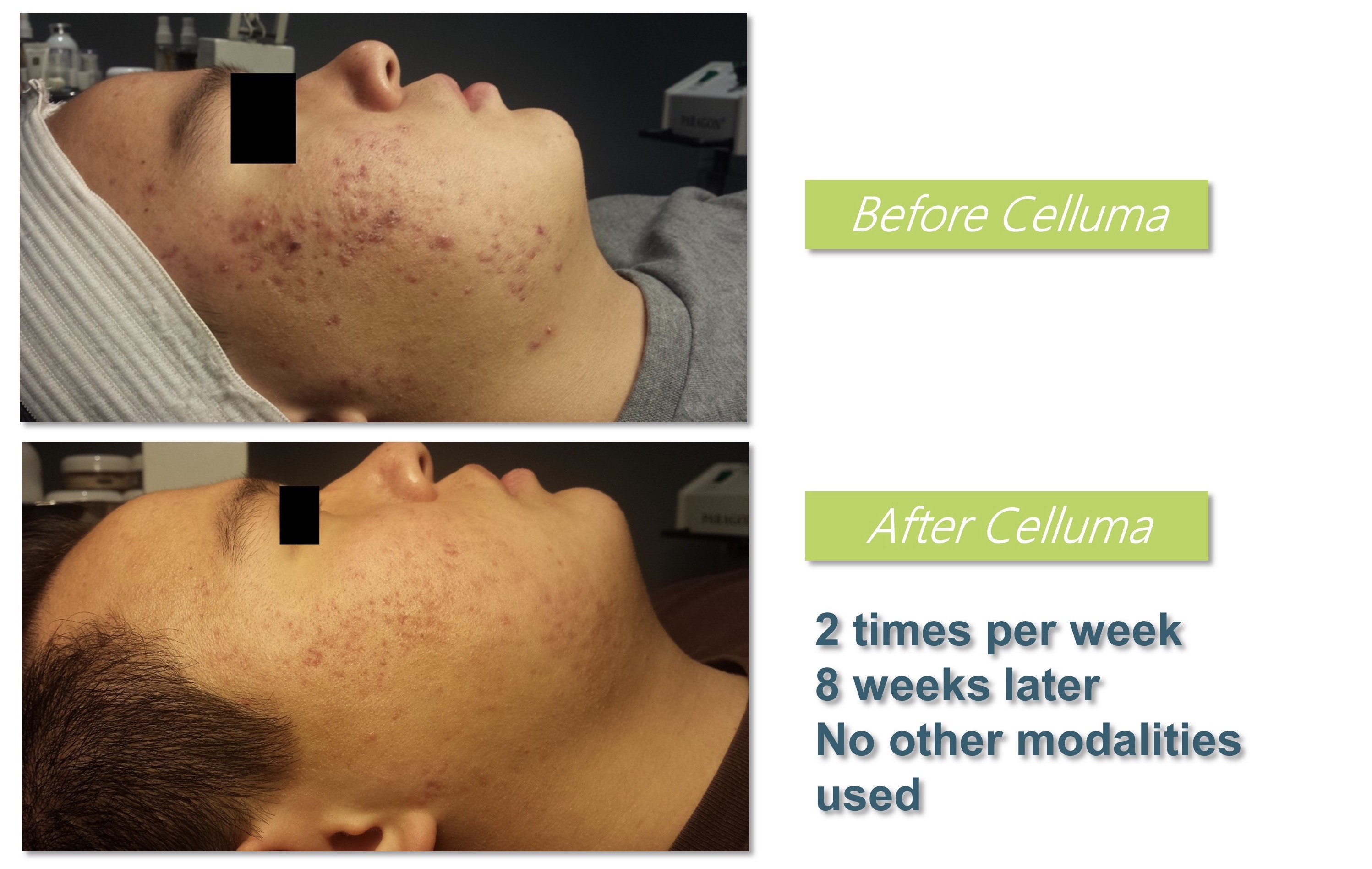 celluma pro częstochowa
