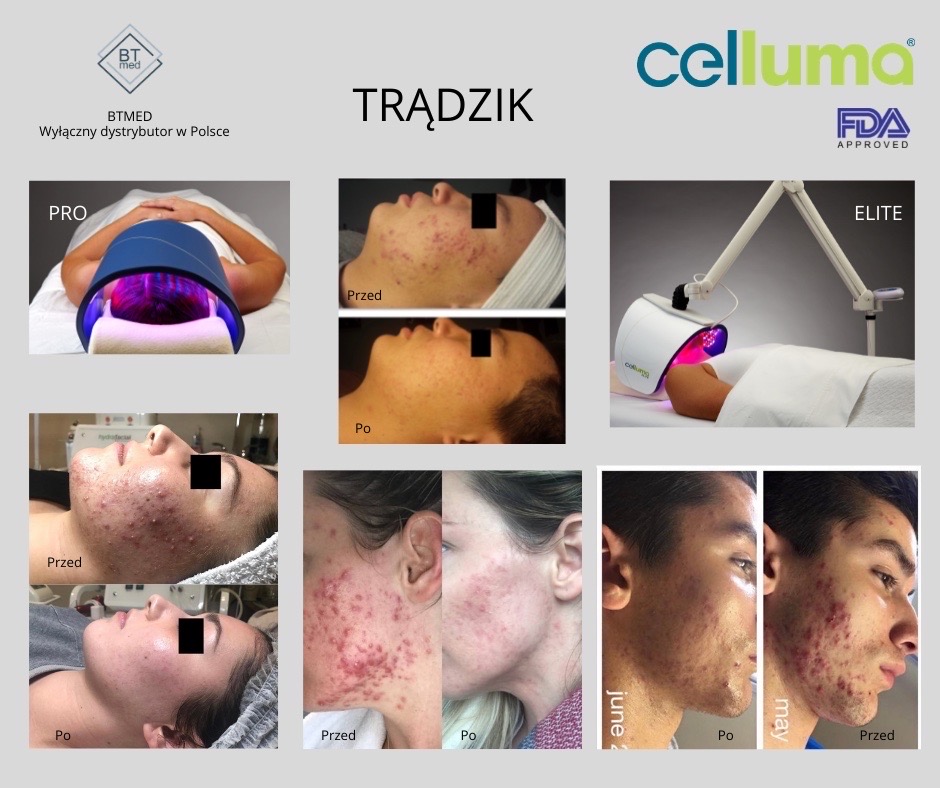 celluma pro częstochowa