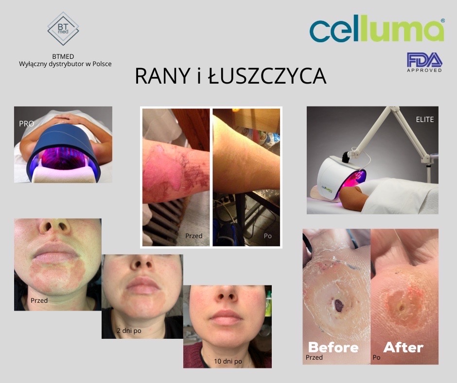 celluma pro częstochowa