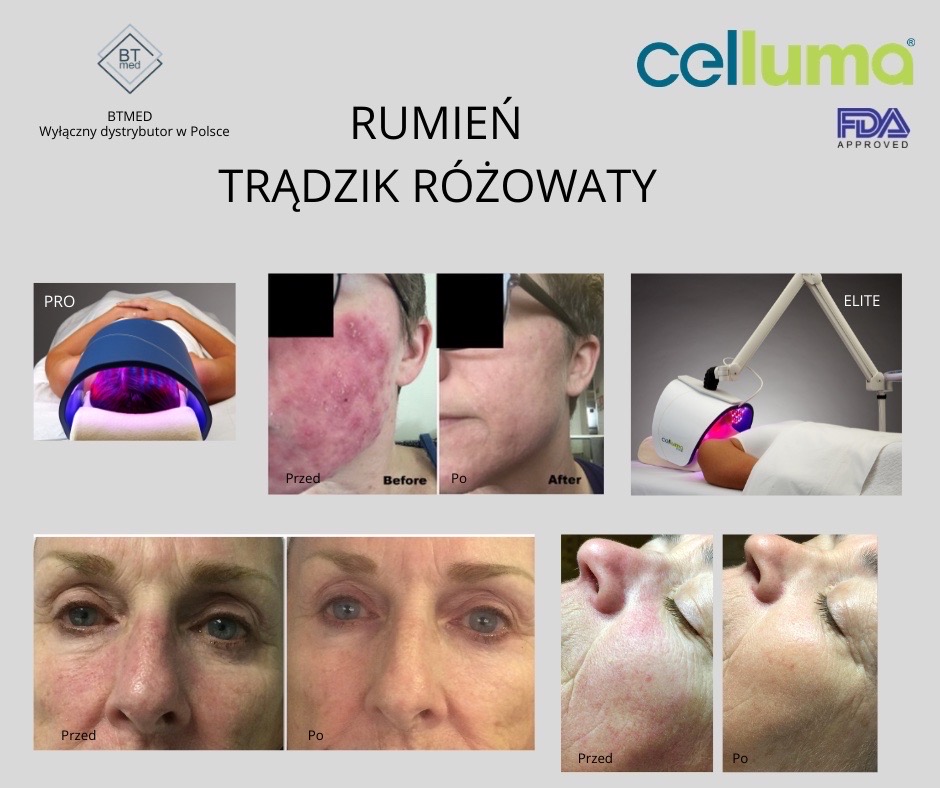 celluma pro częstochowa