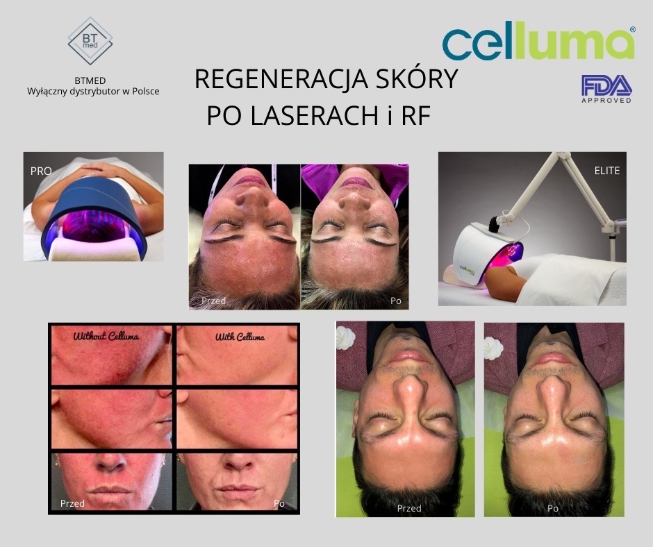 celluma pro częstochowa