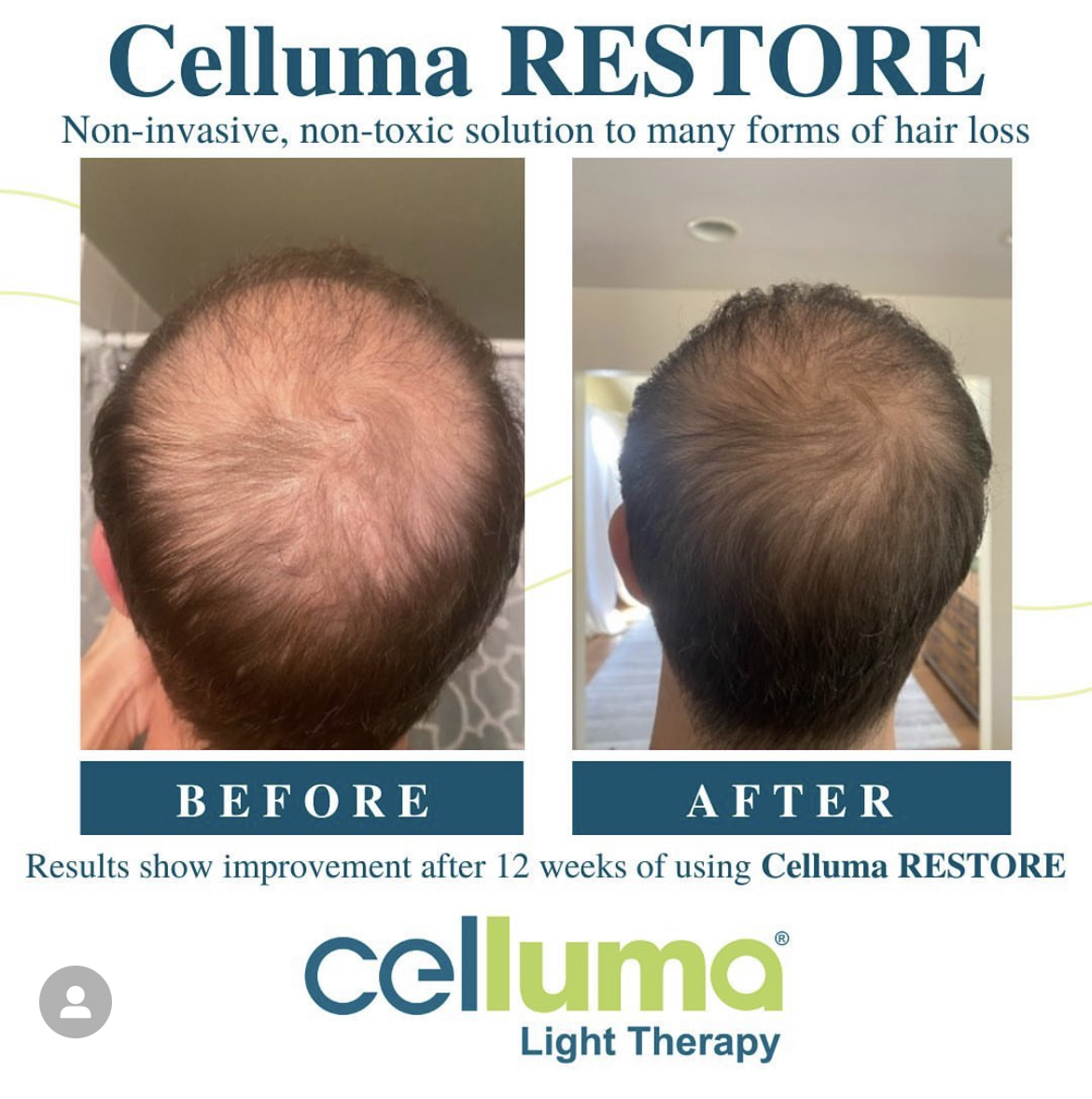 celluma pro częstochowa